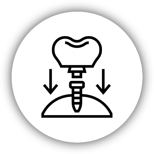 Dental implant tedavisi, eksik dişlerin yerine çene kemiğine yerleştirilen yapay diş kökleriyle kalıcı ve estetik bir çözüm sunar.